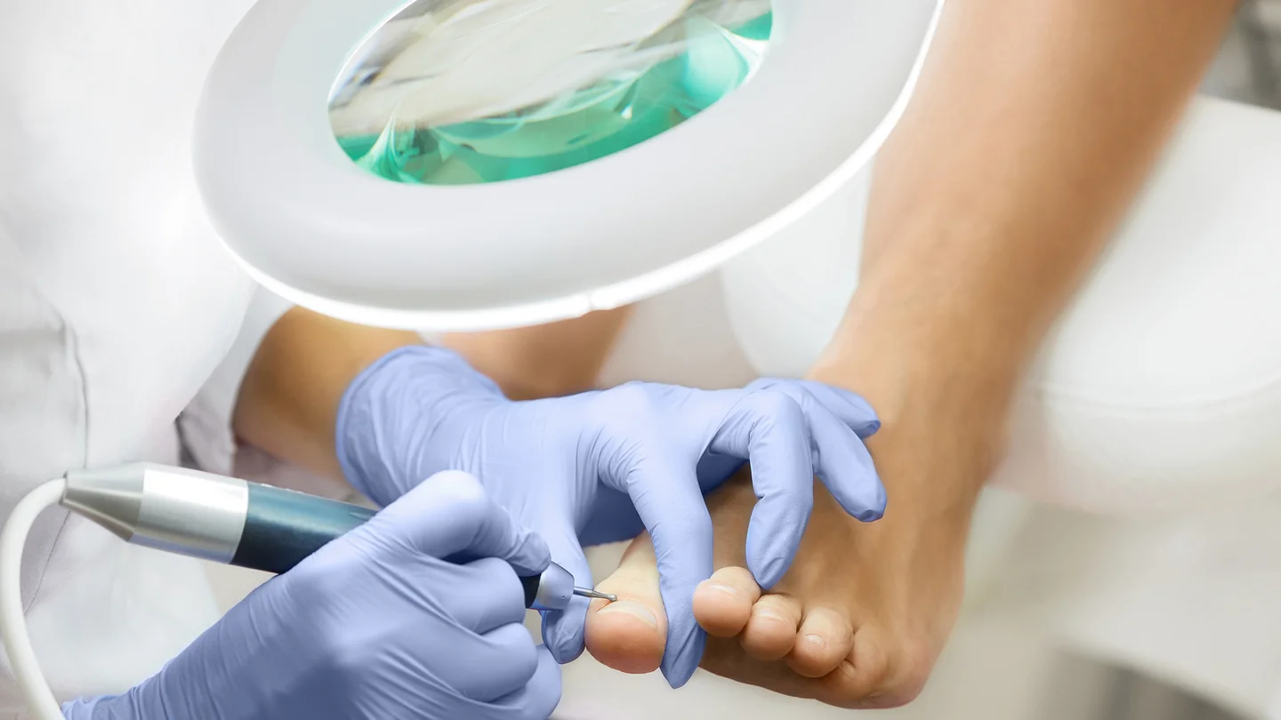 Eine Podologin behandelt mit einem Fu&szlig;pflegeger&auml;t einen Fu&szlig; unter einer Lupenlampe.