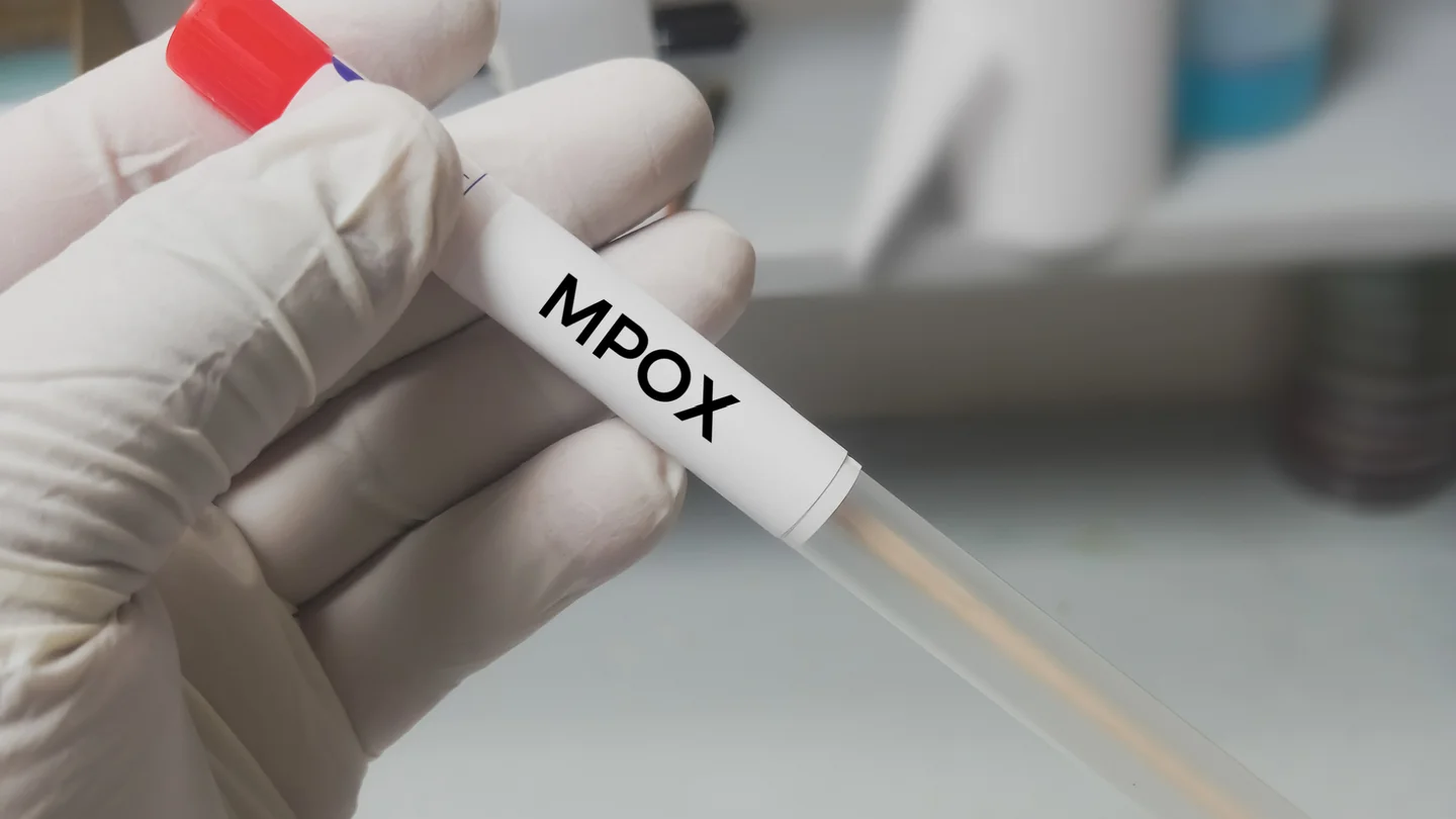 Ein Plastikr&ouml;hrchen mit der Aufschrift &bdquo;MPOX&ldquo;. Im R&ouml;hrchen befindet sich ein Tupfer, mit dem man Abstriche machen kann.