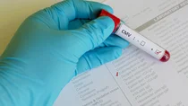 Cytomegalovirus-Infektion: Eine Hand mit einem blauen Schutzhandschuh h&auml;lt ein Testr&ouml;hrchen &uuml;ber ein Formular, auf dem ein H&auml;kchen bei Cytomegalovirus IgM gesetzt ist. Auf dem R&ouml;hrchen klebt ein Aufkleber mit dem Ergebnis CMV positiv.