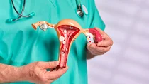 Geb&auml;rmutterk&ouml;rperkrebs (Endometriumkarzinom): Ein Arzt h&auml;lt das Modell einer Geb&auml;rmutter in beiden H&auml;nden.